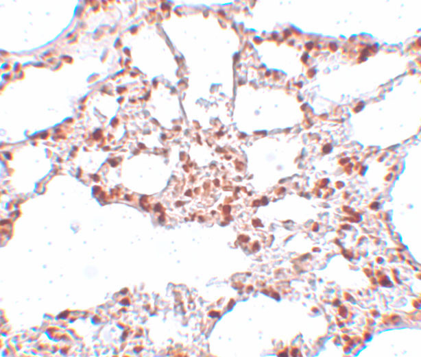 ZSCAN4 Antibody in Immunohistochemistry (IHC)