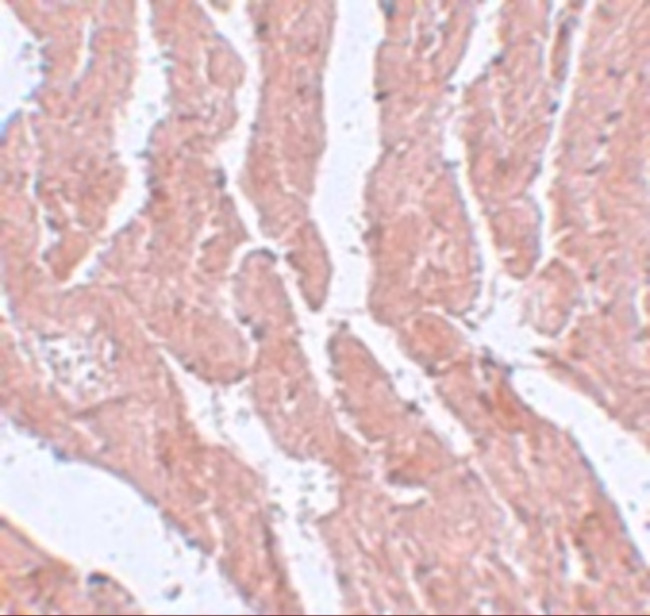 LZTR1 Antibody in Immunohistochemistry (IHC)