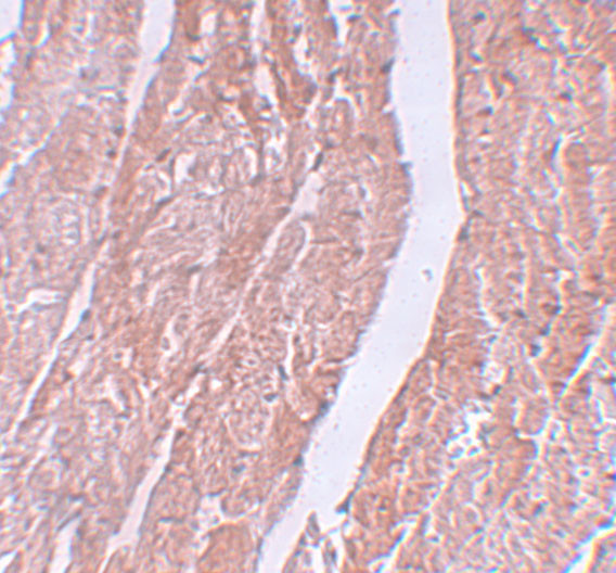 MINA53 Antibody in Immunohistochemistry (IHC)