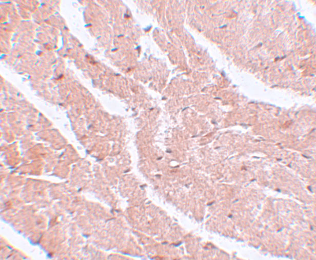 CAZIP Antibody in Immunohistochemistry (IHC)