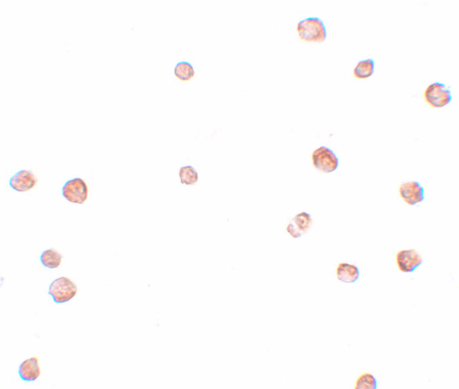 LRRC19 Antibody in Immunocytochemistry (ICC/IF)