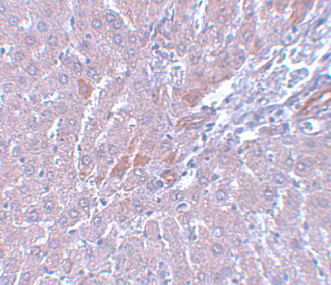 LYRM1 Antibody in Immunohistochemistry (IHC)