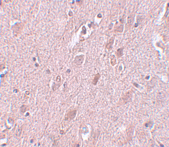 ZC3H12B Antibody in Immunohistochemistry (IHC)