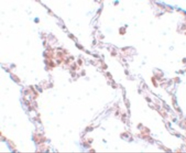TMEM184B Antibody in Immunohistochemistry (IHC)
