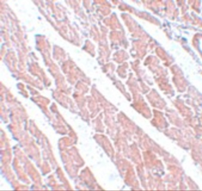 TMEM184C Antibody in Immunohistochemistry (IHC)