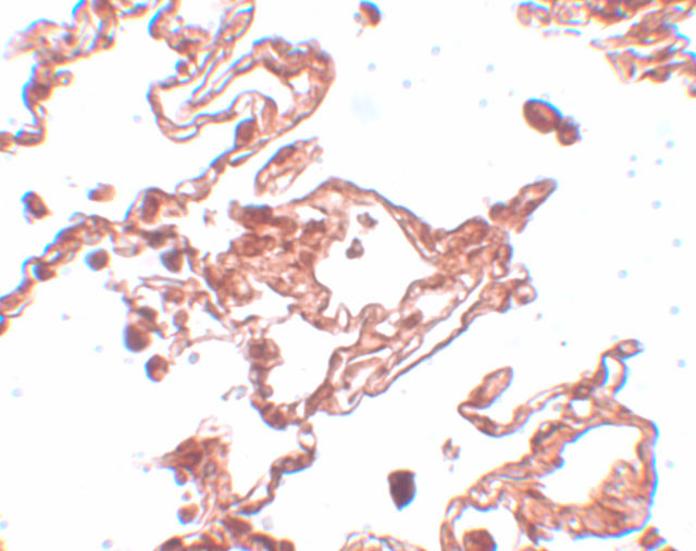CCDC69 Antibody in Immunohistochemistry (IHC)