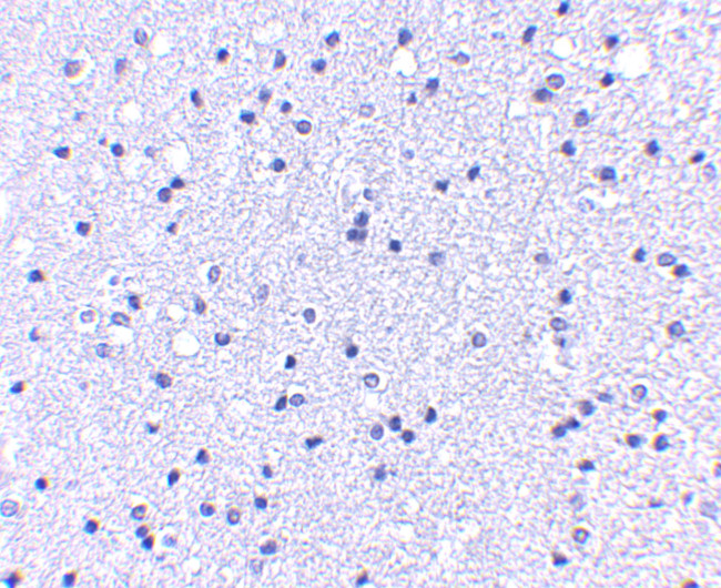 APC1 Antibody in Immunohistochemistry (IHC)