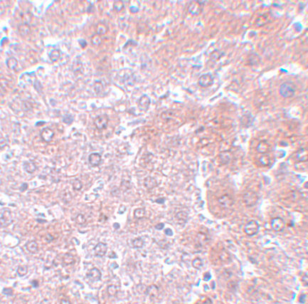 APC4 Antibody in Immunohistochemistry (IHC)