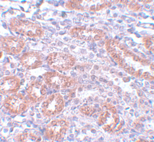 APC5 Antibody in Immunohistochemistry (IHC)