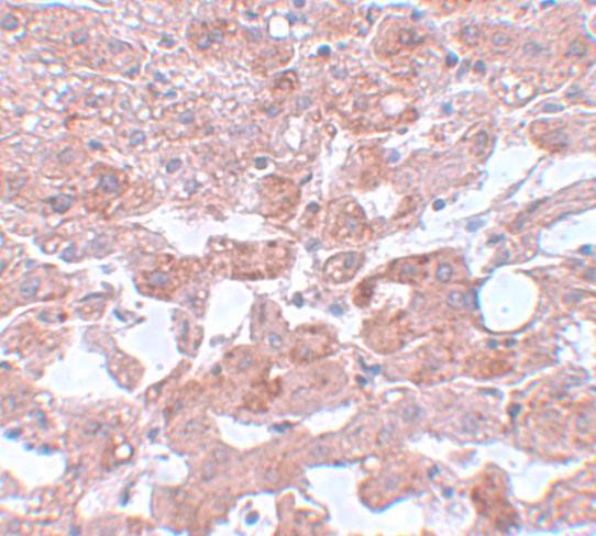 APC6 Antibody in Immunohistochemistry (IHC)