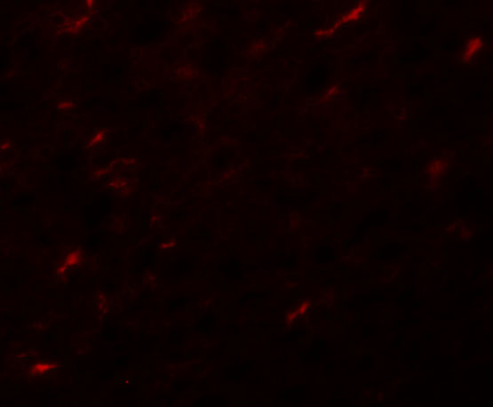APC7 Antibody in Immunohistochemistry (IHC)