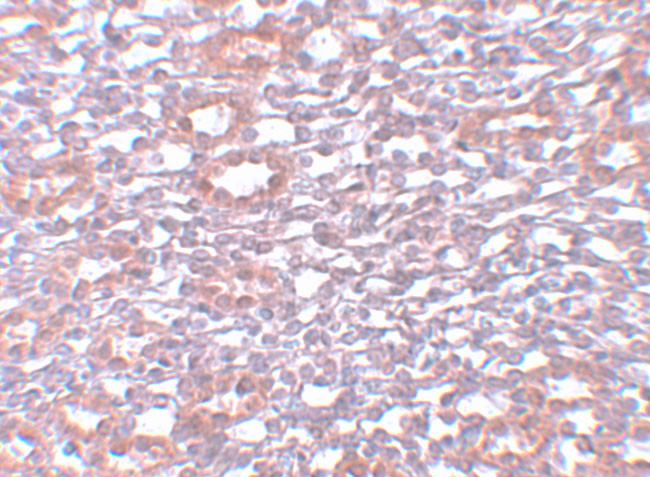 PIAS1 Antibody in Immunohistochemistry (IHC)