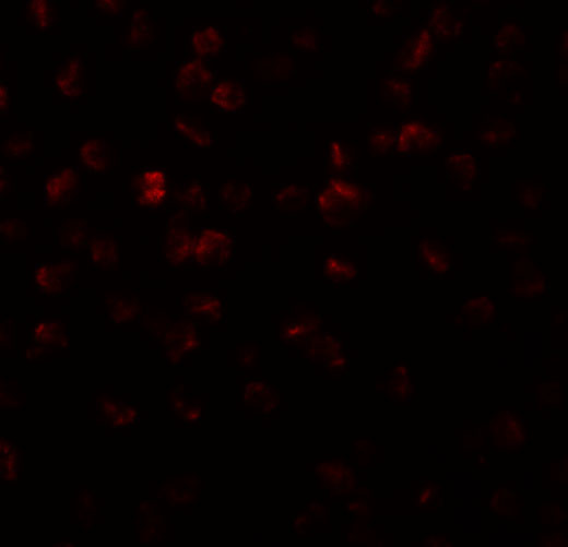 APC11 Antibody in Immunocytochemistry (ICC/IF)