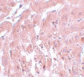 SUMO2/SUMO3 Antibody in Immunohistochemistry (IHC)