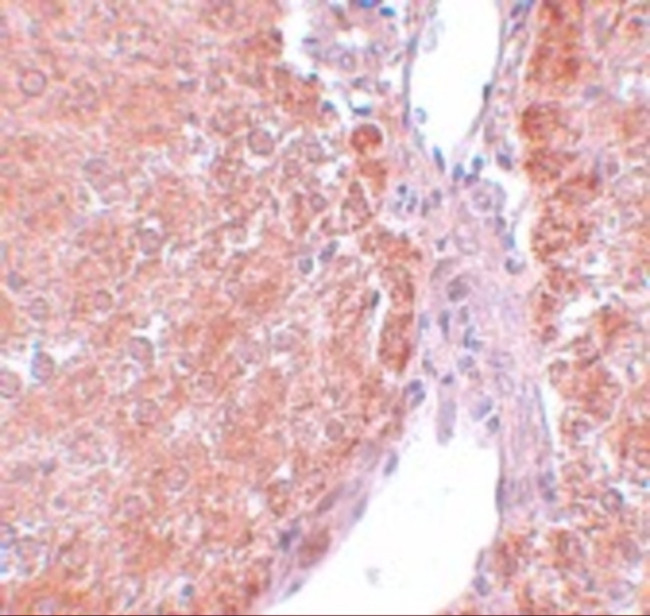 SUMO-3 Antibody in Immunohistochemistry (IHC)