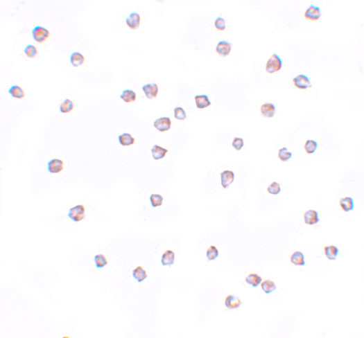 FREM2 Antibody in Immunocytochemistry (ICC/IF)