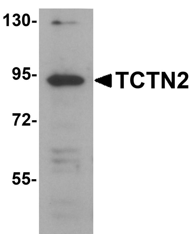 TCTN2 Antibody in Western Blot (WB)