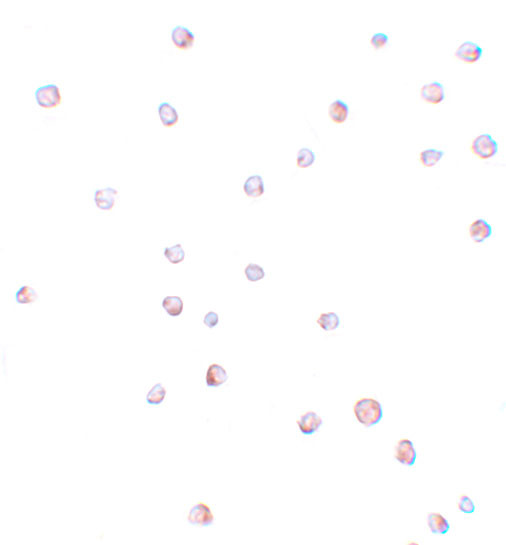 USP10 Antibody in Immunocytochemistry (ICC/IF)