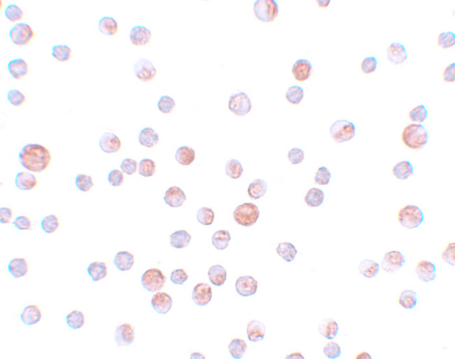 CABP7 Antibody in Immunocytochemistry (ICC/IF)