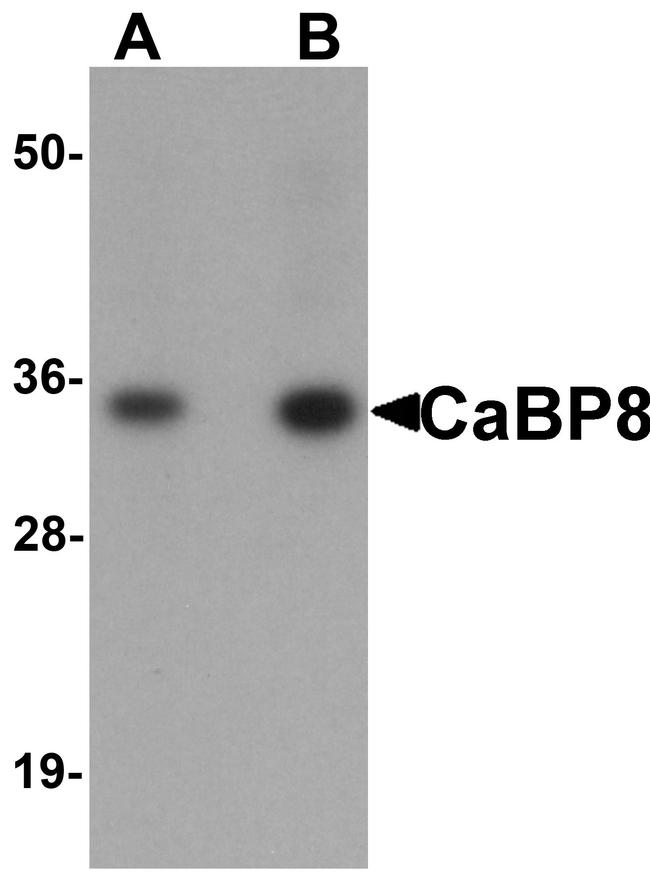 CaBP8 Antibody in Western Blot (WB)