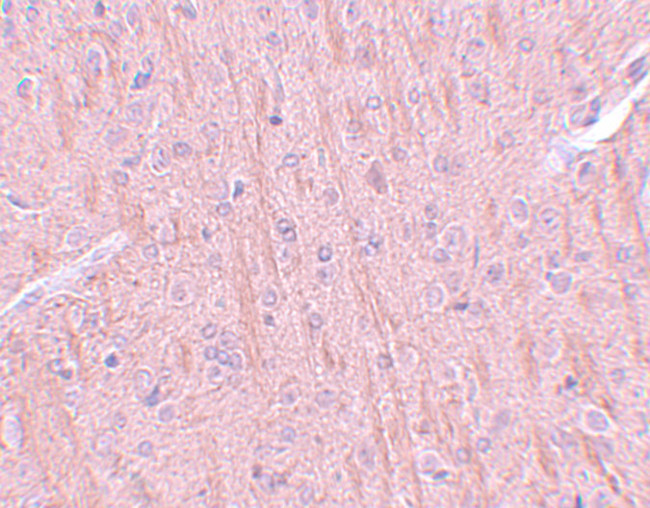 CCDC106 Antibody in Immunohistochemistry (IHC)