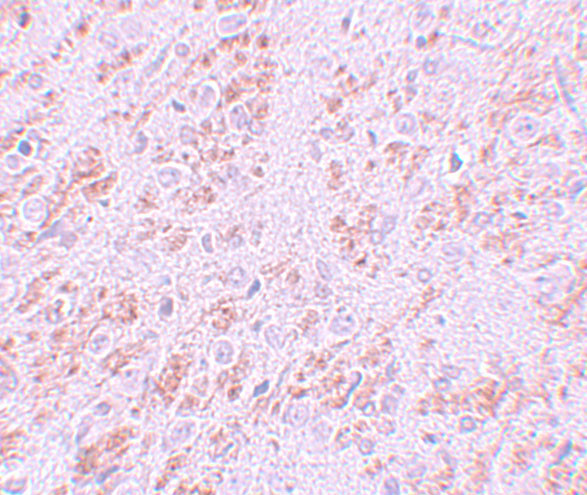 VENTX Antibody in Immunohistochemistry (IHC)