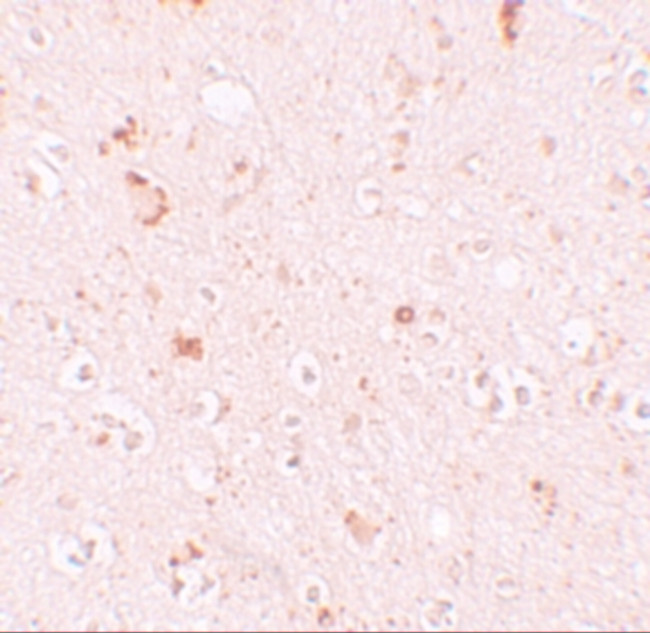 SH3RF2 Antibody in Immunohistochemistry (IHC)