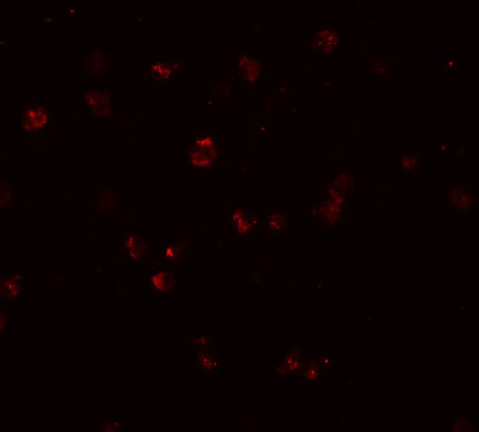 NOD3 Antibody in Immunocytochemistry (ICC/IF)