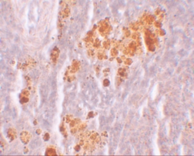 NLRX1 Antibody in Immunohistochemistry (IHC)