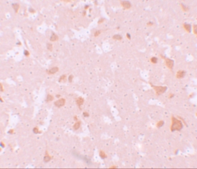 NALP7 Antibody in Immunohistochemistry (IHC)