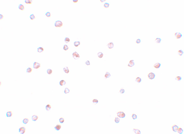 TRIP6 Antibody in Immunocytochemistry (ICC/IF)