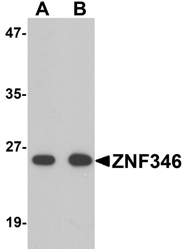 ZNF346 Antibody in Western Blot (WB)