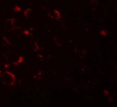AXIN1 Antibody in Immunohistochemistry (IHC)