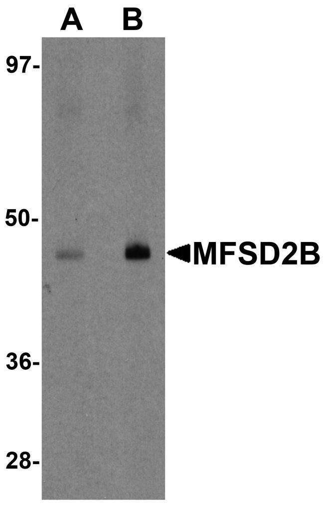 MFSD2B Antibody in Western Blot (WB)