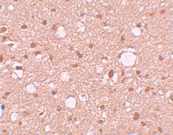 APBA2 Antibody in Immunohistochemistry (IHC)