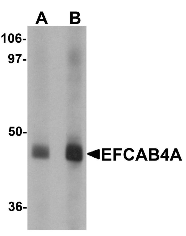 EFCAB4A Antibody in Western Blot (WB)