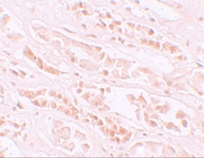 EFCAB4B Antibody in Immunohistochemistry (IHC)