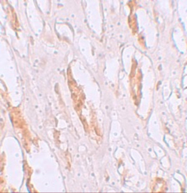 ZIP1 Antibody in Immunohistochemistry (IHC)