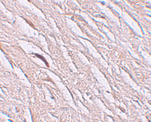 SLC39A2 Antibody in Immunohistochemistry (IHC)