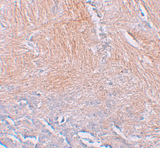 CXXC5 Antibody in Immunohistochemistry (IHC)