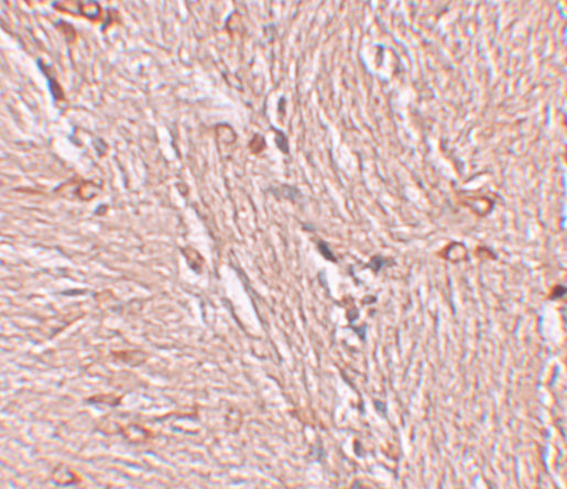 ZBTB4 Antibody in Immunohistochemistry (IHC)
