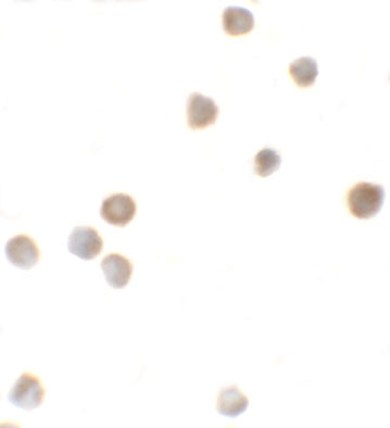 ZBTB6 Antibody in Immunocytochemistry (ICC/IF)