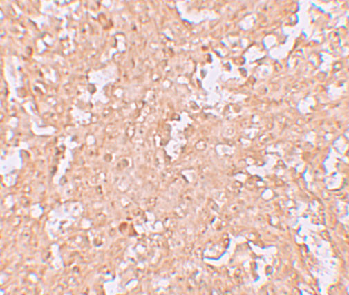 ZBTB8A Antibody in Immunohistochemistry (IHC)
