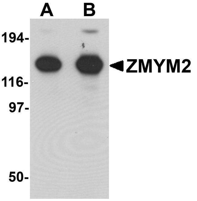 ZMYM2 Antibody in Western Blot (WB)