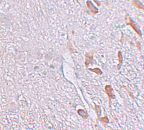 LRRTM1 Antibody in Immunohistochemistry (IHC)