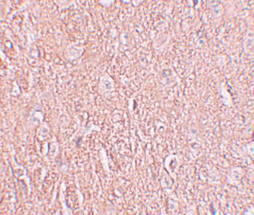 LRRTM2 Antibody in Immunohistochemistry (IHC)