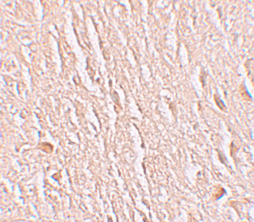 LRRTM3 Antibody in Immunohistochemistry (IHC)