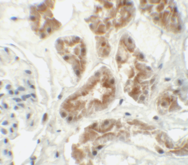 ZNF346 Antibody in Immunohistochemistry (IHC)