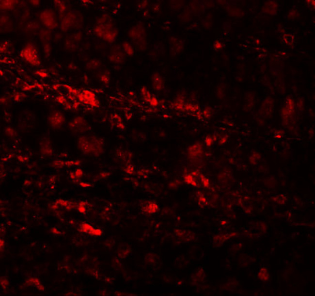 ESRP1 Antibody in Immunohistochemistry (IHC)