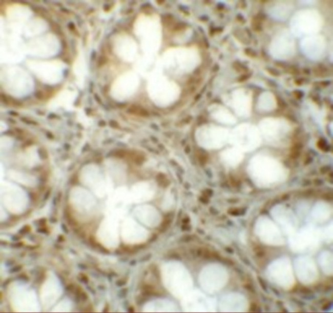 LRRFIP1 Antibody in Immunohistochemistry (IHC)